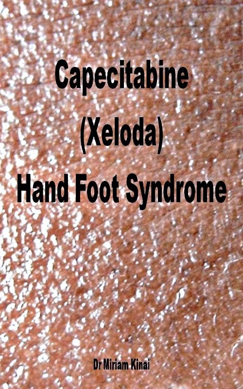 Product picture Capecitabine (Xeloda) Hand Foot Syndrome